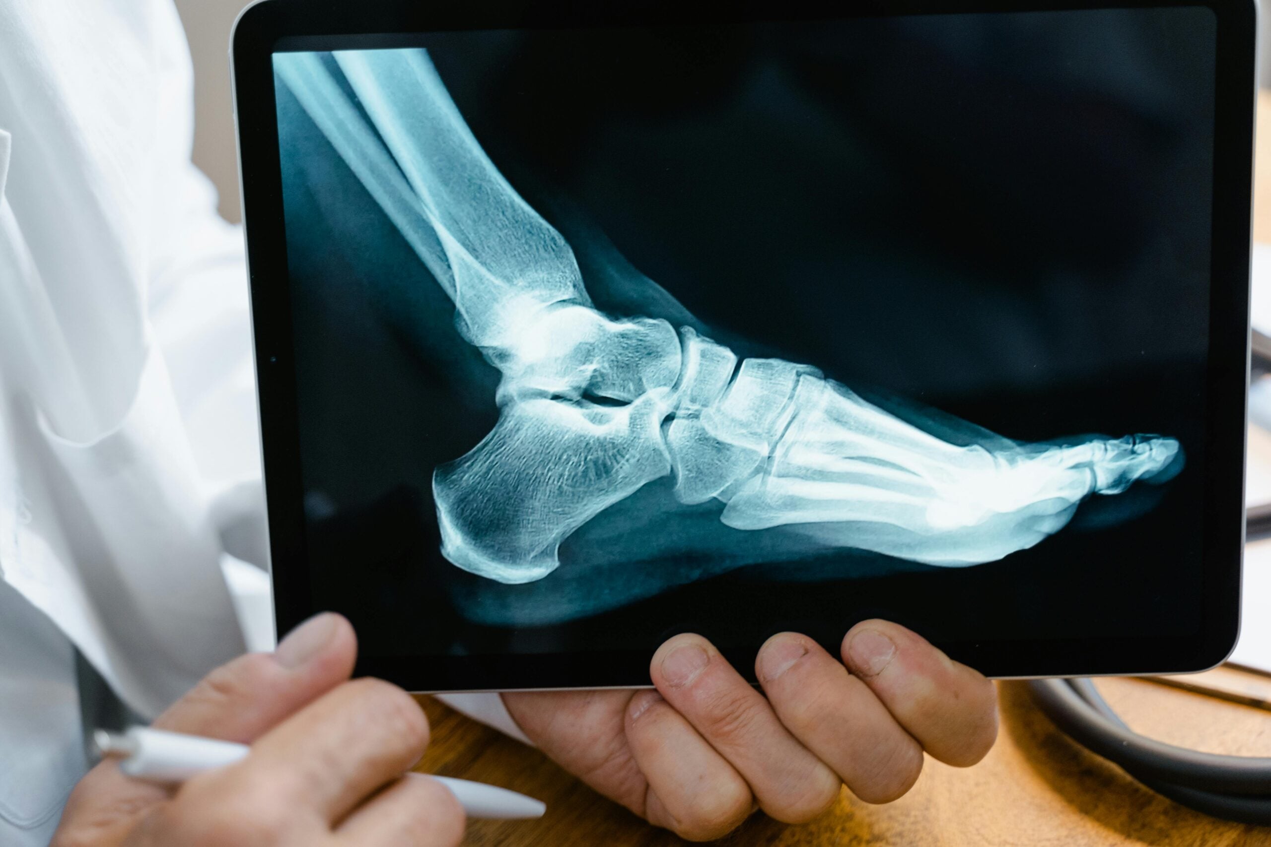 injury settlement